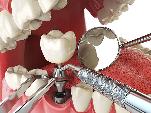 Best Emergency Gum Treatment in Fremont, NC